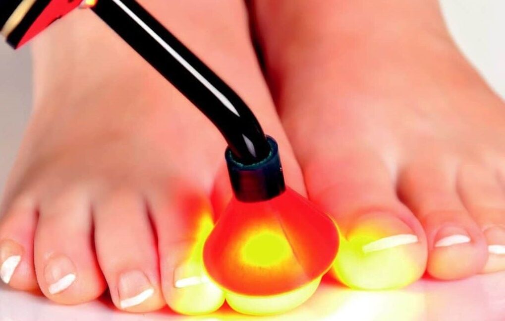 Tratamentul laser al plăcii de unghii